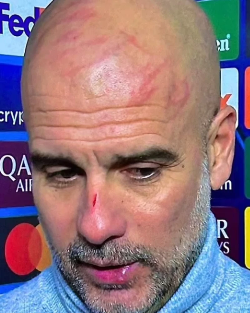 Pep Guardiola