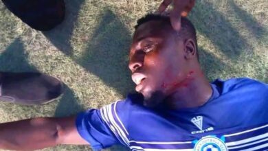 Warning: image contains graphic content of an injured player.