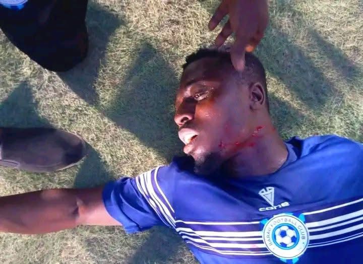 Warning: image contains graphic content of an injured player.
